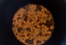 Elderly athlete breaks Thai 100m record – for centenarians